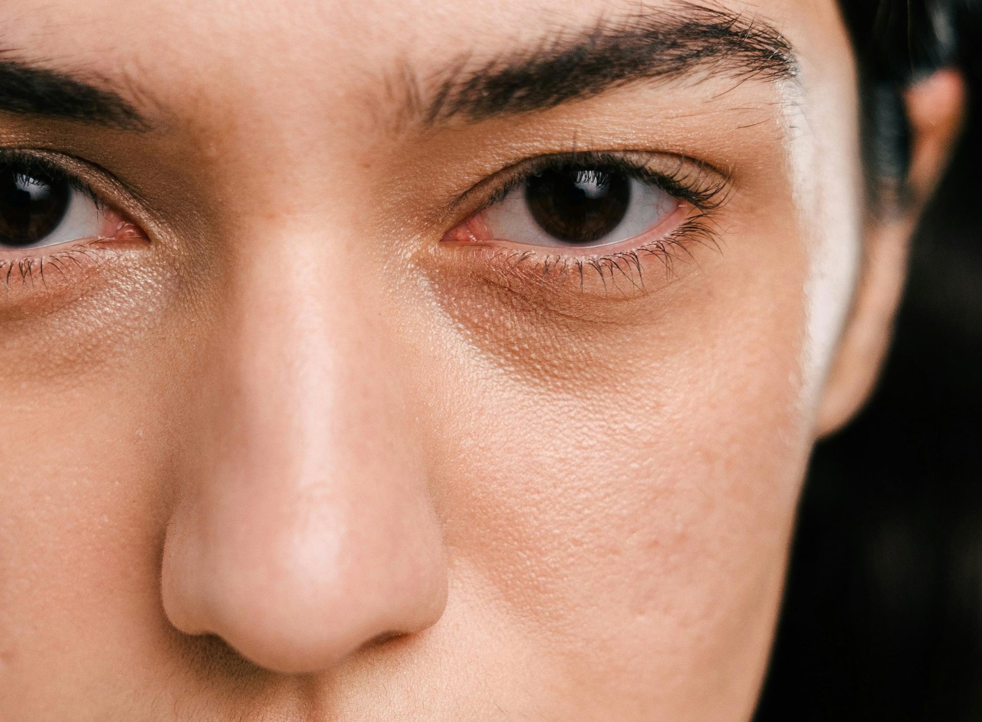 Woher kommen Augenringe und geschwollene Augen – und was hilft wirklich?